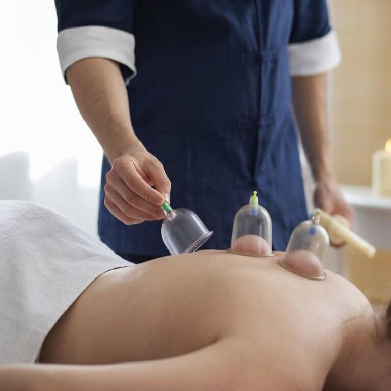 Benefits of Cupping Therapy Services in Gurgaon