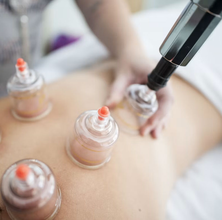 Best Hijama Therapy carenurse healthcare in Gurgaon