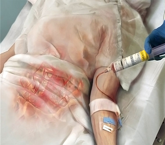 Cancer patient receiving compassionate home healthcare
