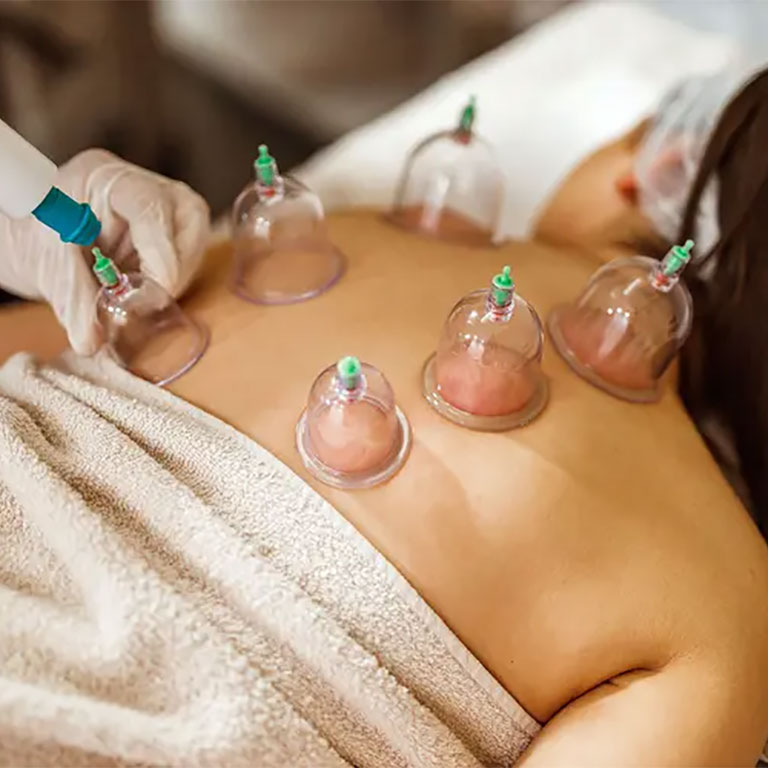 carenurse-healthcare-cupping-therapy-at-home-in-gurgaon