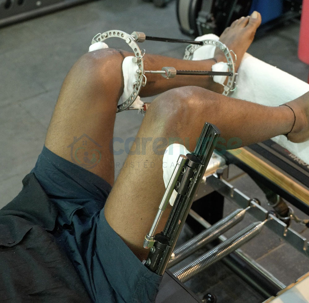 CARENURSE Height Increase Surgery in Gurgaon India