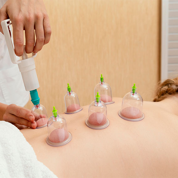 Hijama therapy services in Gurgaon by CareNurse