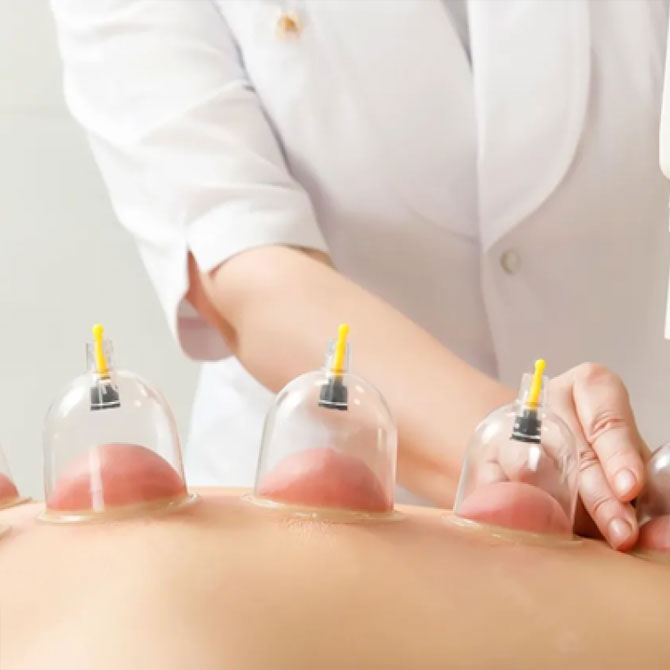 Sunnah Hijama in Gurgaon